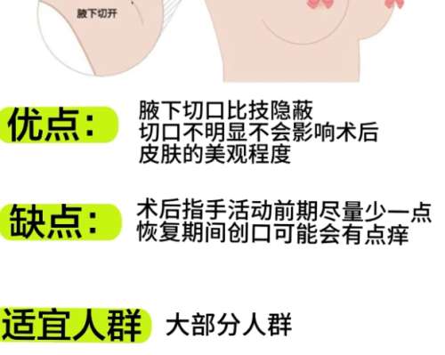 隆胸