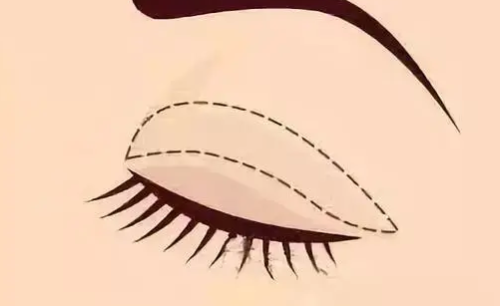 vx截图_20230828172504.png
