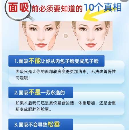 面部吸脂