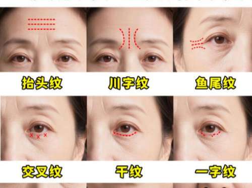 除皱1.jpg