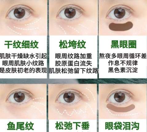 去眼袋