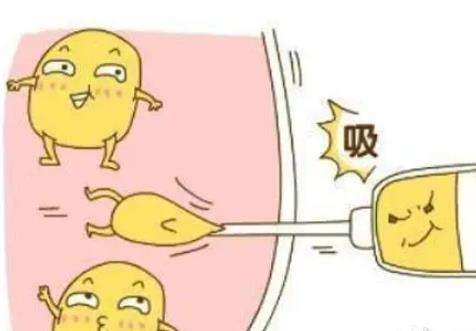吸脂 吸脂
