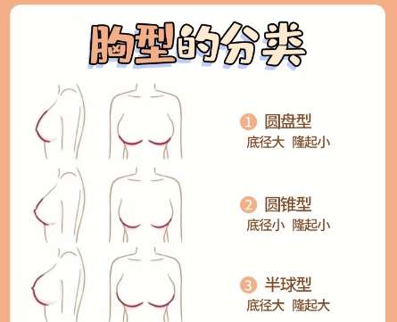 隆胸