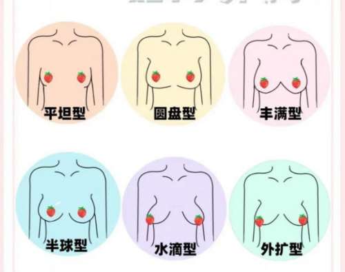 隆胸