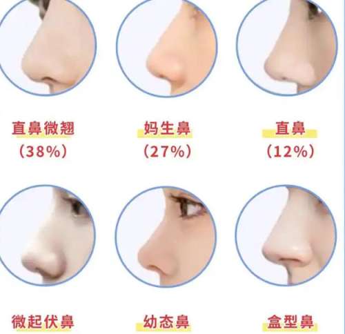 隆鼻