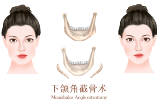 QQ浏览器截图20230920081843.png