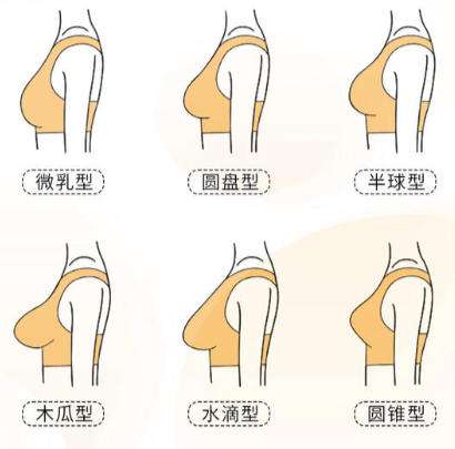 隆胸