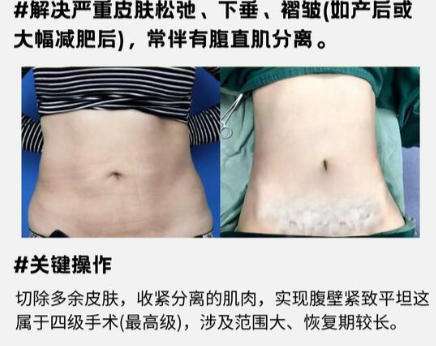 宁波市第二医院