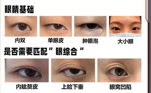双眼皮   .jpg