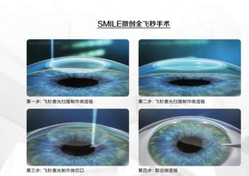 全飞秒2.jpg