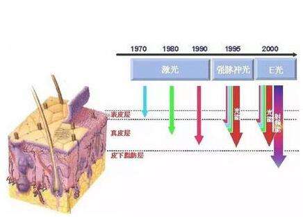 激光.jpg