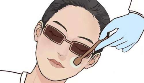 光子嫩肤2.jpg