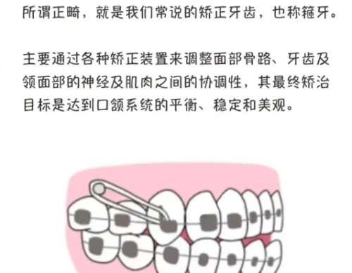 正畸