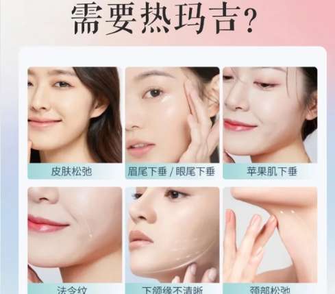 热玛吉