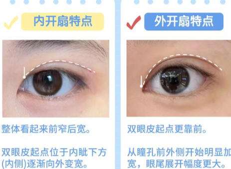 眼综合2.jpg