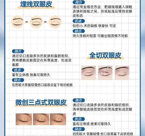 双眼皮