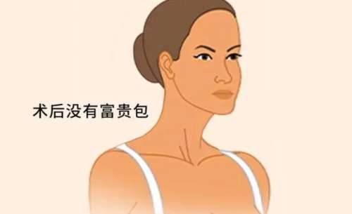 富贵包