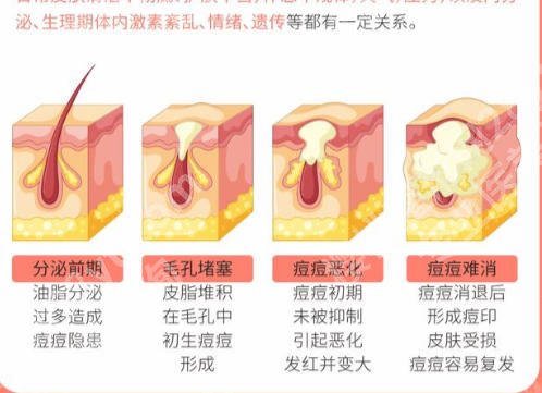 龙岩第一医院激光祛痘印费用怎么样？医院信息一览了解