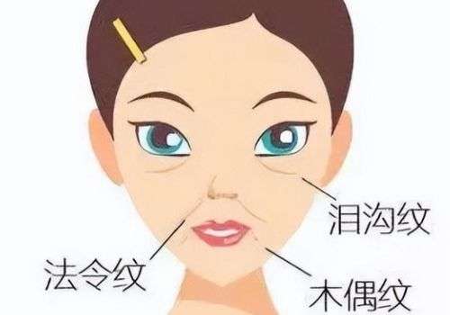 成都成华区法令纹深，注射填充多少钱(合规版)，盘点了三位实力派医生
