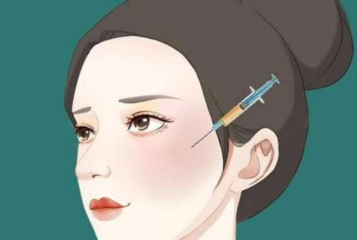 上海九院曹卫岗脂肪填充怎么样？技术成熟，协调性好