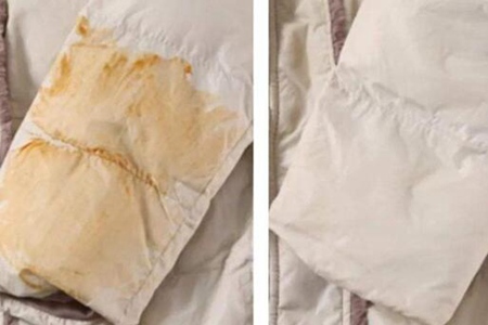 心衰症状表现有哪些？这五个症状感到不舒服要救救心脏